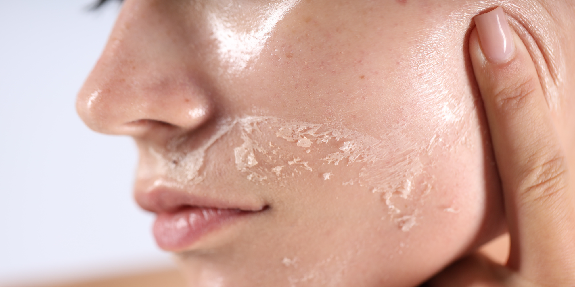 Why Your Skin Still Feels Dry After Moisturizing — And How to Fix It